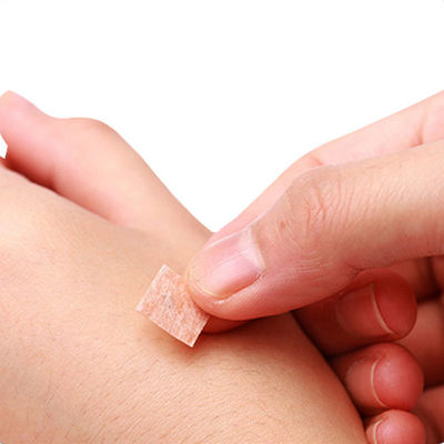 เข็มกดจุดฝังเข็มพร้อมด้ามพลาสติก GB 2024-2016 มาตรฐานความปลอดภัยเพื่อการรักษาที่มีประสิทธิภาพและสะดวกสบาย