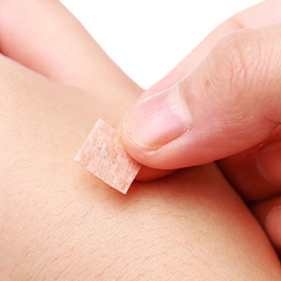 สายเข็มกลาก จํานวน 100 ชิ้นต่อกล่อง วิธีการใส่และปล่อย สายเข็มกลาก